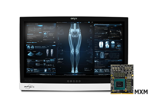 医療用エッジAIコンピュータ